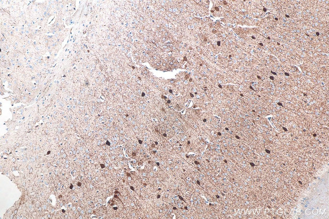 Parvalbumin Antibody in Immunohistochemistry (Paraffin) (IHC (P))