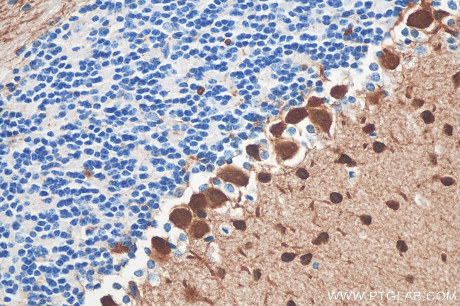 Parvalbumin Antibody in Immunohistochemistry (Paraffin) (IHC (P))