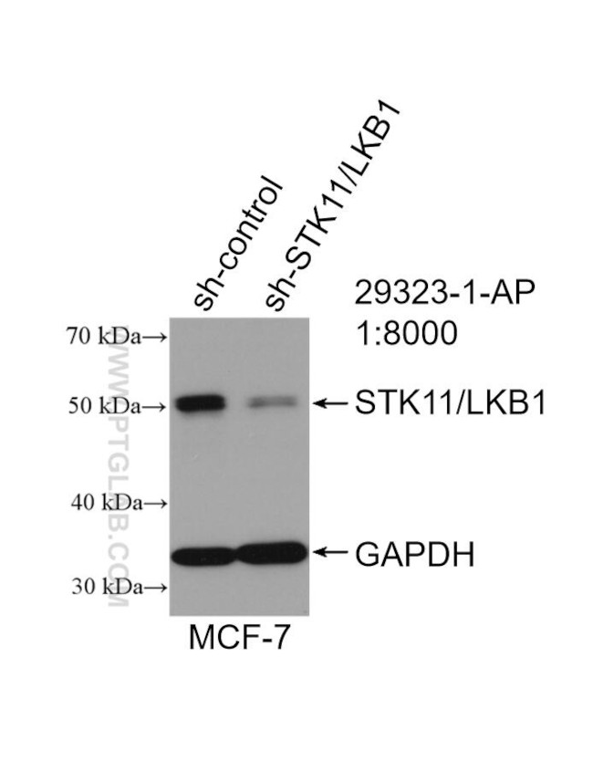 STK11/LKB1 Antibody in Western Blot (WB)