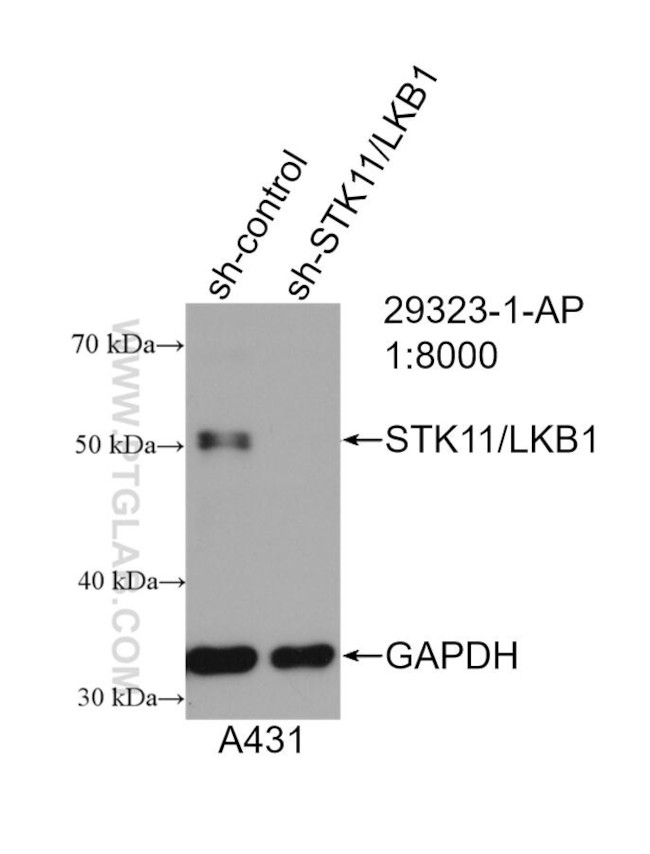 STK11/LKB1 Antibody in Western Blot (WB)