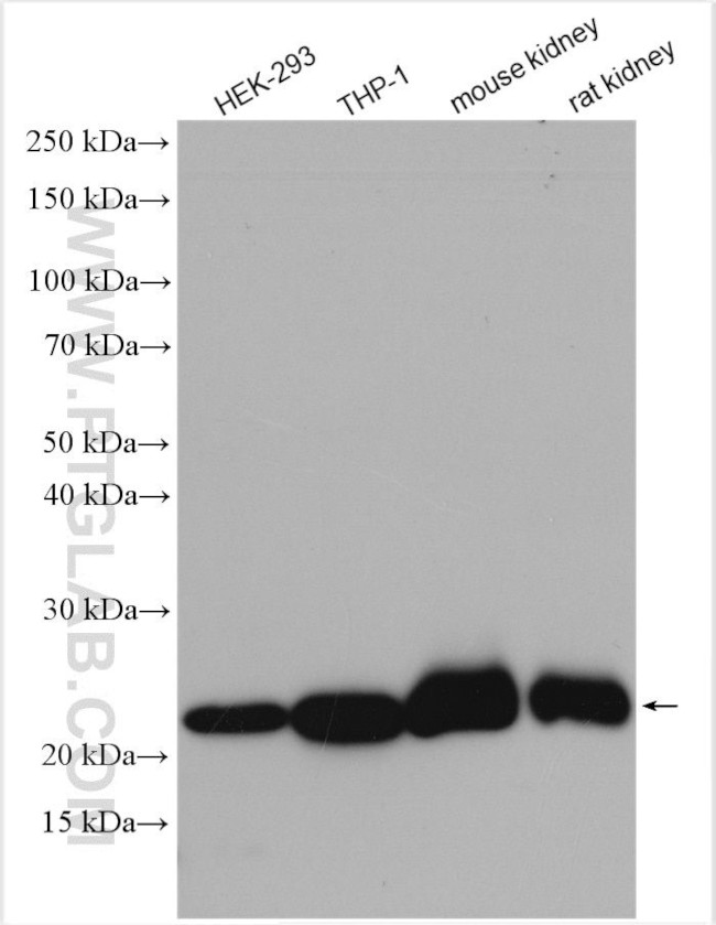 GPX1 Antibody in Western Blot (WB)