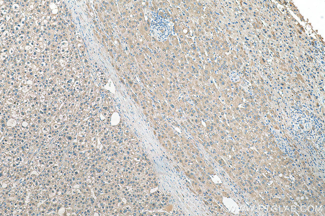 ALDH1A3 Antibody in Immunohistochemistry (Paraffin) (IHC (P))