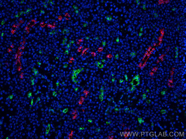 AQP2 Antibody in Immunohistochemistry (Paraffin) (IHC (P))