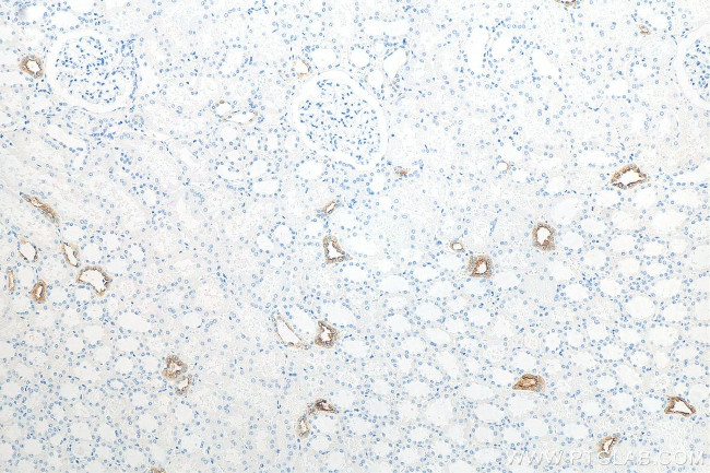 AQP2 Antibody in Immunohistochemistry (Paraffin) (IHC (P))