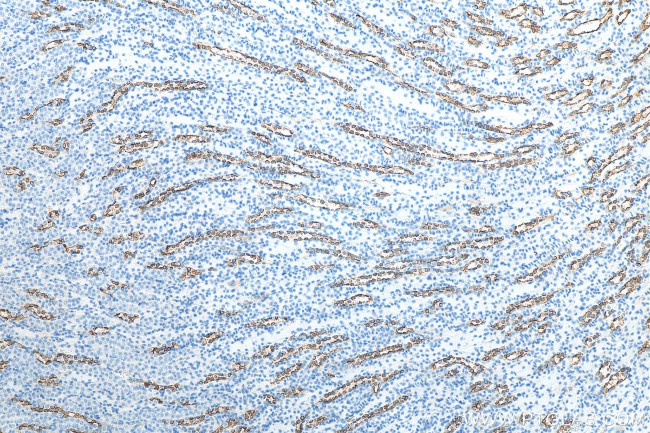 AQP2 Antibody in Immunohistochemistry (Paraffin) (IHC (P))