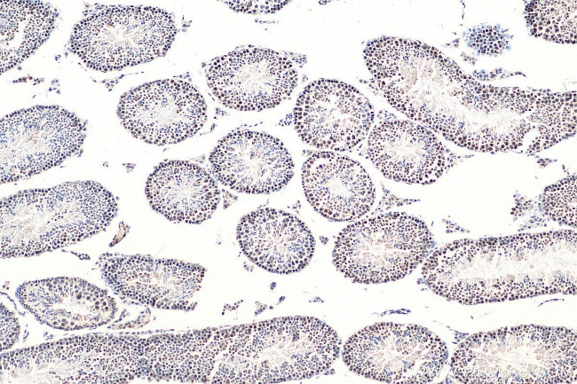 RAD50 Antibody in Immunohistochemistry (Paraffin) (IHC (P))