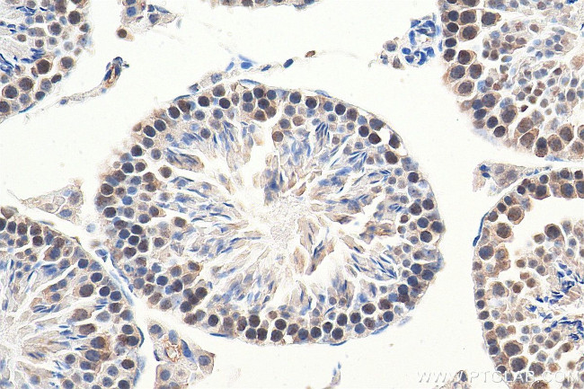 RAD50 Antibody in Immunohistochemistry (Paraffin) (IHC (P))