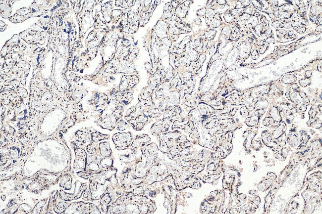 RAD50 Antibody in Immunohistochemistry (Paraffin) (IHC (P))