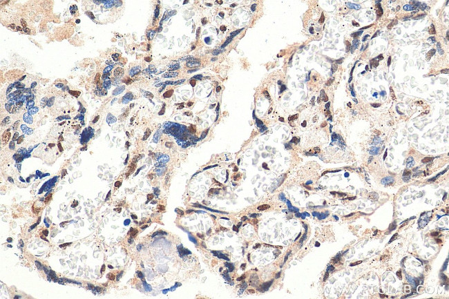 RAD50 Antibody in Immunohistochemistry (Paraffin) (IHC (P))