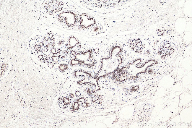 RAD50 Antibody in Immunohistochemistry (Paraffin) (IHC (P))