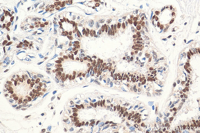 RAD50 Antibody in Immunohistochemistry (Paraffin) (IHC (P))