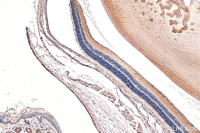 TPBG Antibody in Immunohistochemistry (Paraffin) (IHC (P))