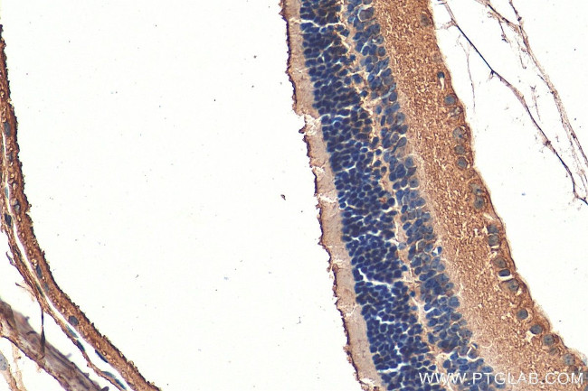 TPBG Antibody in Immunohistochemistry (Paraffin) (IHC (P))