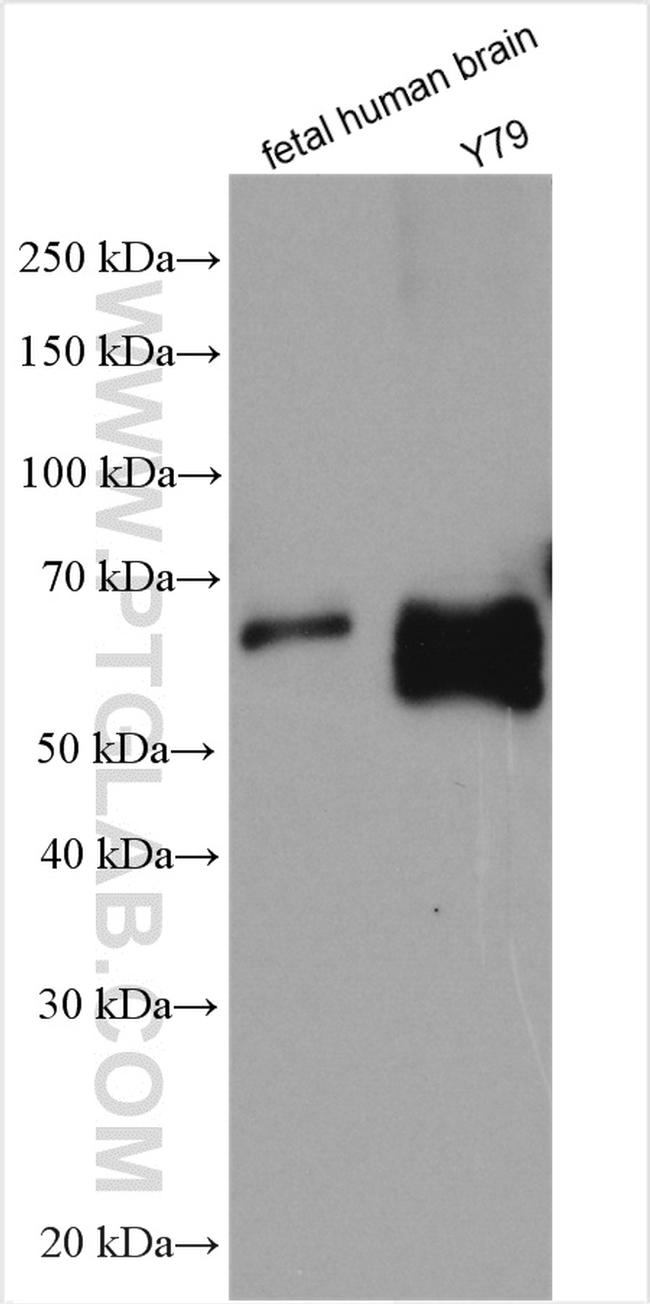 SOX11 Antibody in Western Blot (WB)