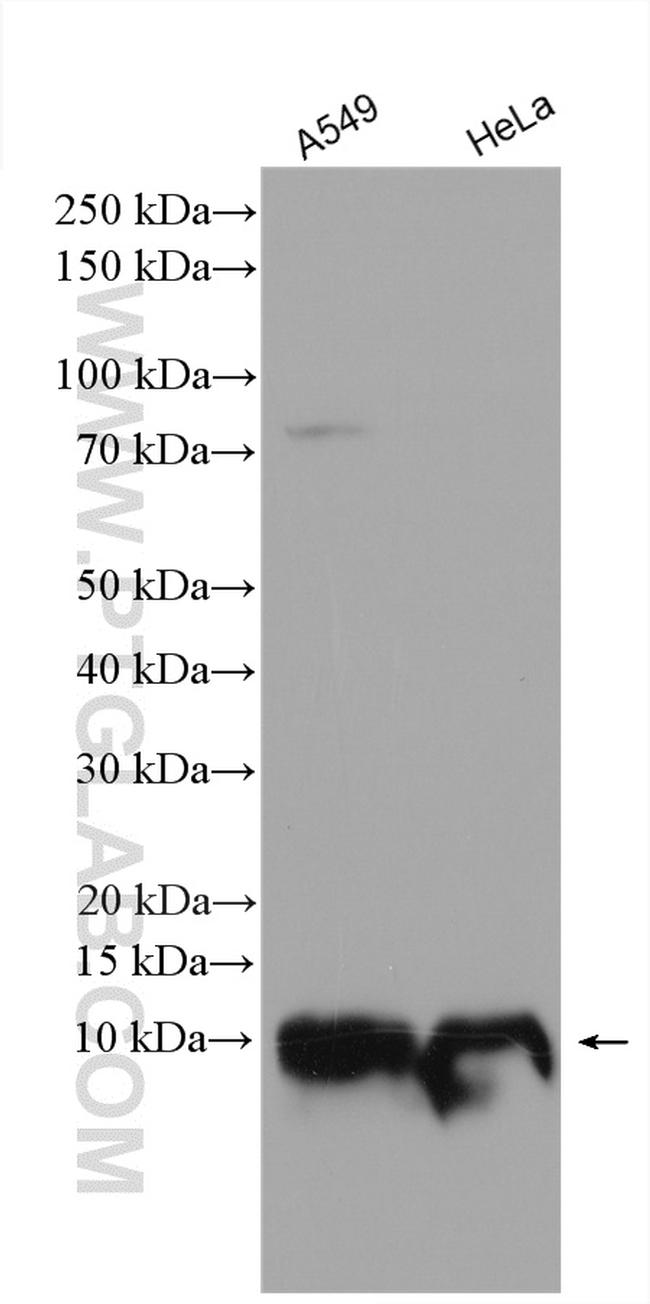 IER3IP1 Antibody in Western Blot (WB)