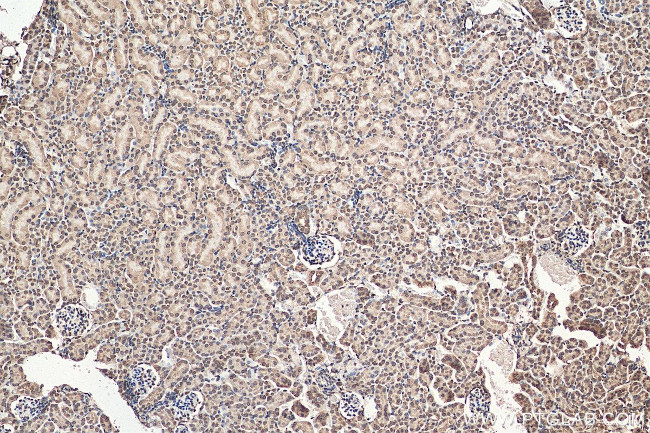 LEMD2 Antibody in Immunohistochemistry (Paraffin) (IHC (P))