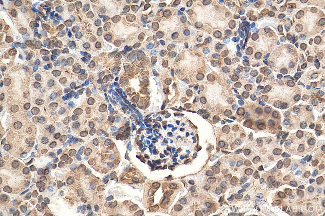 LEMD2 Antibody in Immunohistochemistry (Paraffin) (IHC (P))