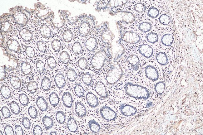 LEMD2 Antibody in Immunohistochemistry (Paraffin) (IHC (P))