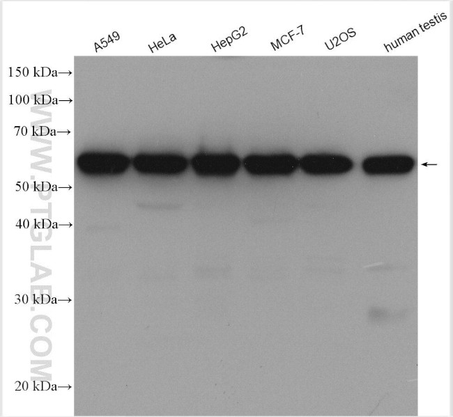 LEMD2 Antibody in Western Blot (WB)