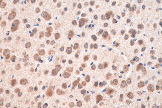 PTPRS Antibody in Immunohistochemistry (Paraffin) (IHC (P))