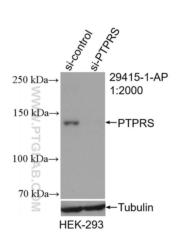 PTPRS Antibody in Western Blot (WB)