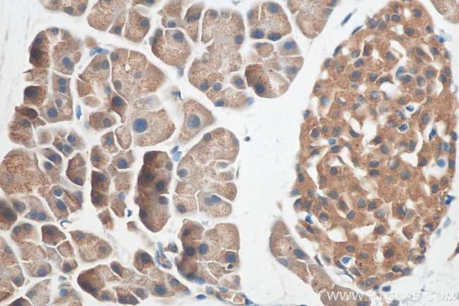 SEC16A Antibody in Immunohistochemistry (Paraffin) (IHC (P))