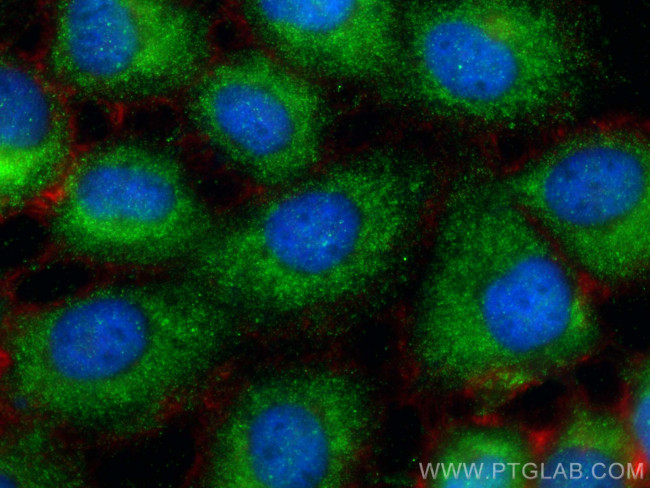 Fibrillin 1 Antibody in Immunocytochemistry (ICC/IF)