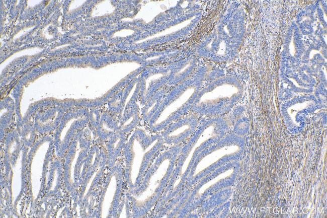 Fibrillin 1 Antibody in Immunohistochemistry (Paraffin) (IHC (P))