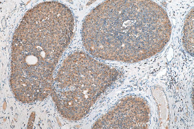 FUT8 Antibody in Immunohistochemistry (Paraffin) (IHC (P))