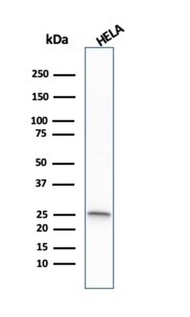 Glutathione S-Transferase Mu1 (GSTM1) Antibody in Western Blot (WB)