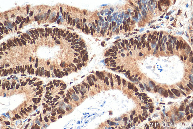 YTHDC1 Antibody in Immunohistochemistry (Paraffin) (IHC (P))