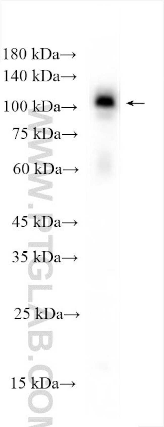 YTHDC1 Antibody in Western Blot (WB)