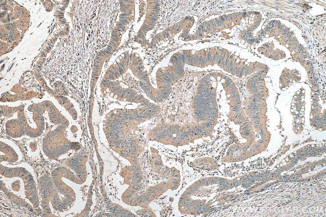 ATG16L1 Antibody in Immunohistochemistry (Paraffin) (IHC (P))