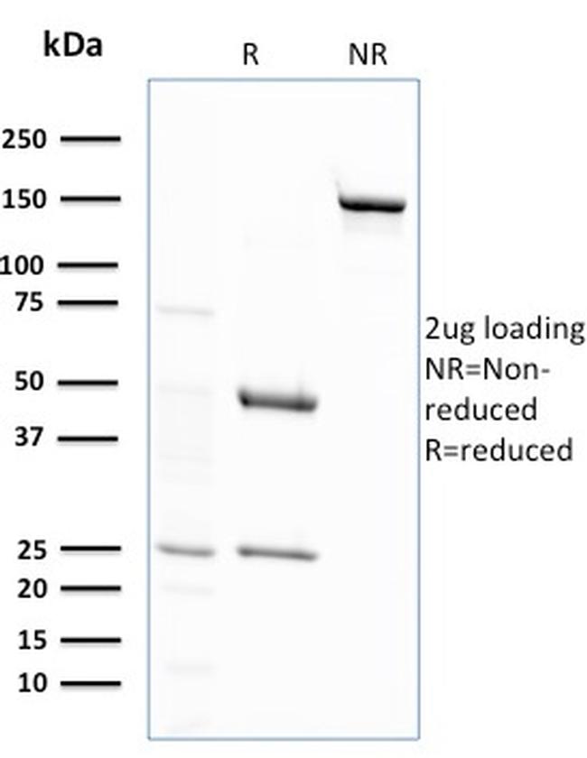 Glutathione S-Transferase Mu2 (GSTM2) Antibody in SDS-PAGE (SDS-PAGE)