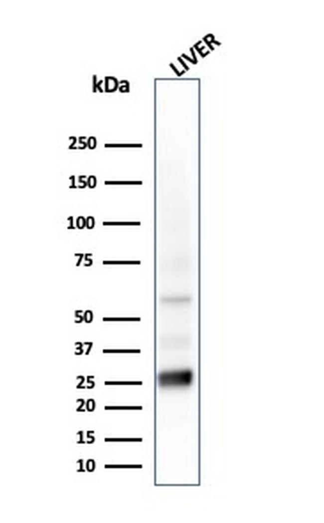 Glutathione S-Transferase Mu2 (GSTM2) Antibody in Western Blot (WB)