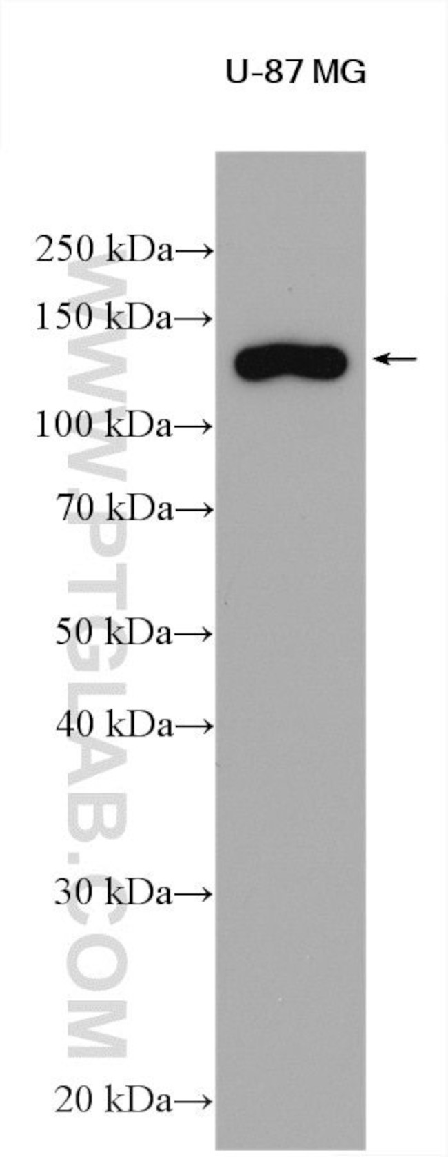 SNF2L Antibody in Western Blot (WB)