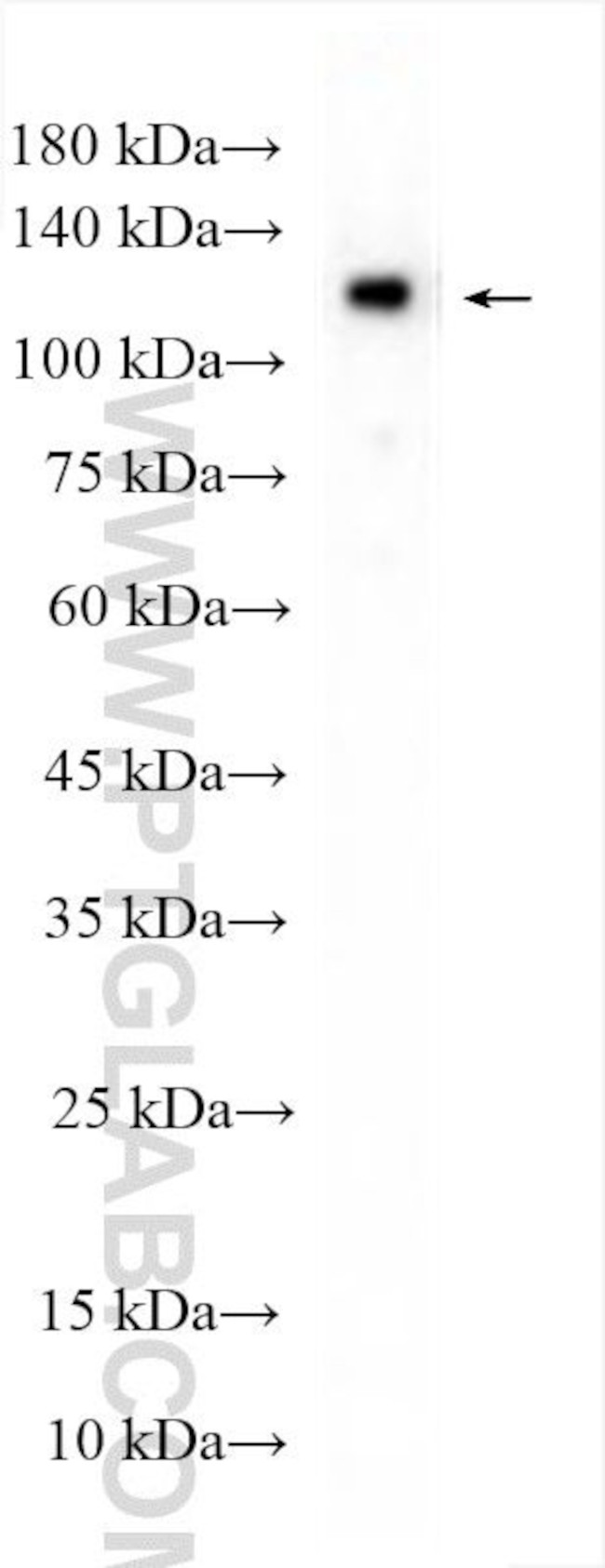 SNF2L Antibody in Western Blot (WB)