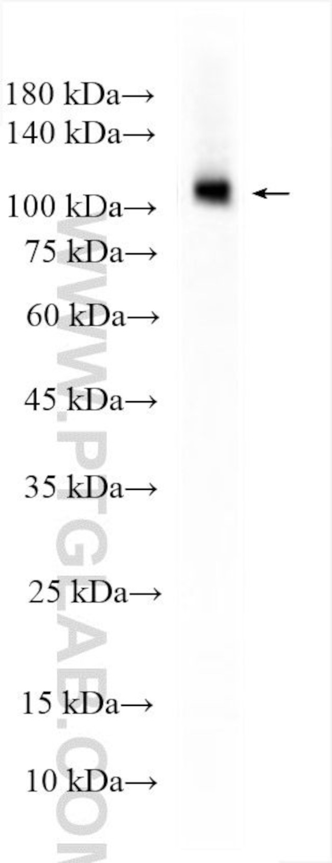 SNF2L Antibody in Western Blot (WB)