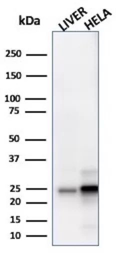 Glutathione S-Transferase Mu3 (GSTM3) Antibody in Western Blot (WB)