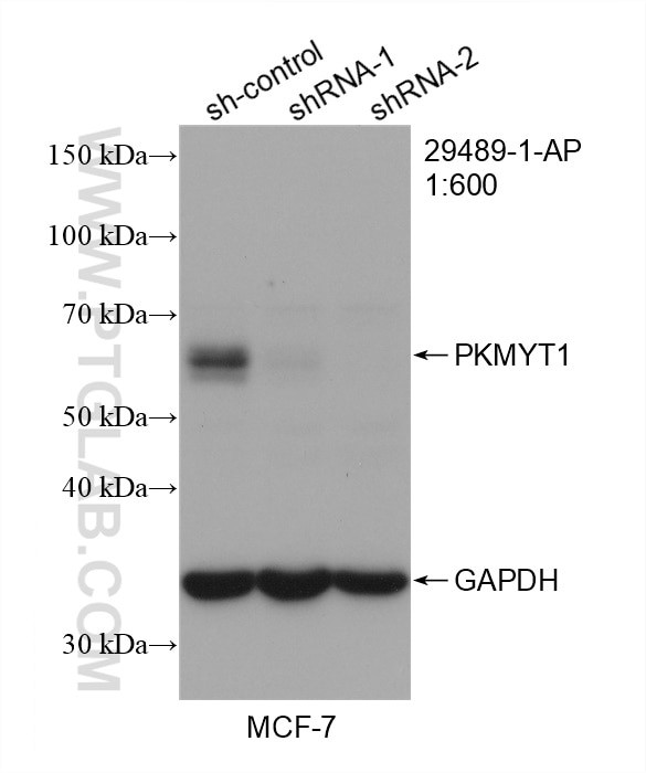 PKMYT1 Antibody in Western Blot (WB)