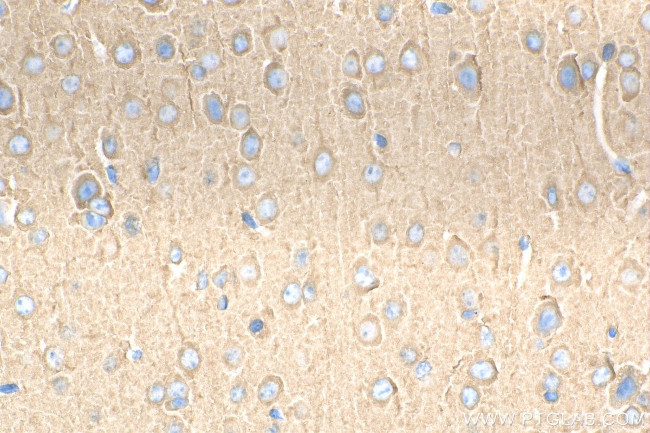 CRMP1 Antibody in Immunohistochemistry (Paraffin) (IHC (P))