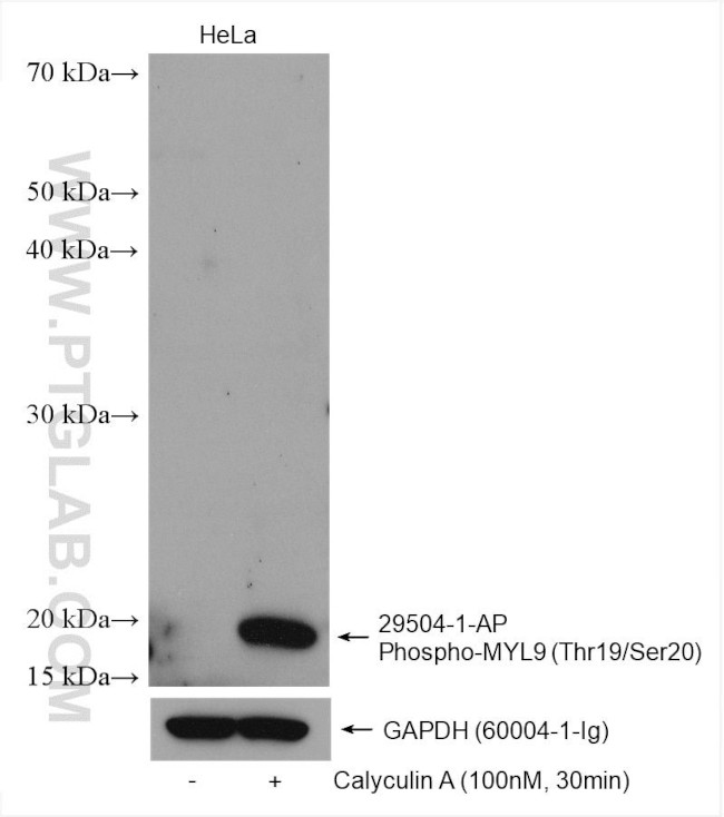 Phospho-MYL9 (Thr19, Ser20) Antibody in Western Blot (WB)