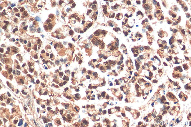 PHF8 Antibody in Immunohistochemistry (Paraffin) (IHC (P))