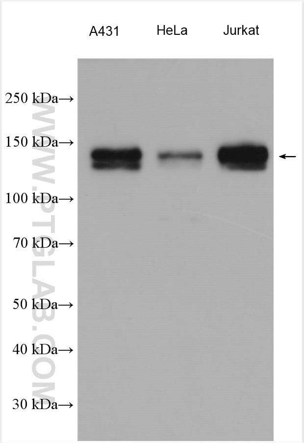 PHF8 Antibody in Western Blot (WB)