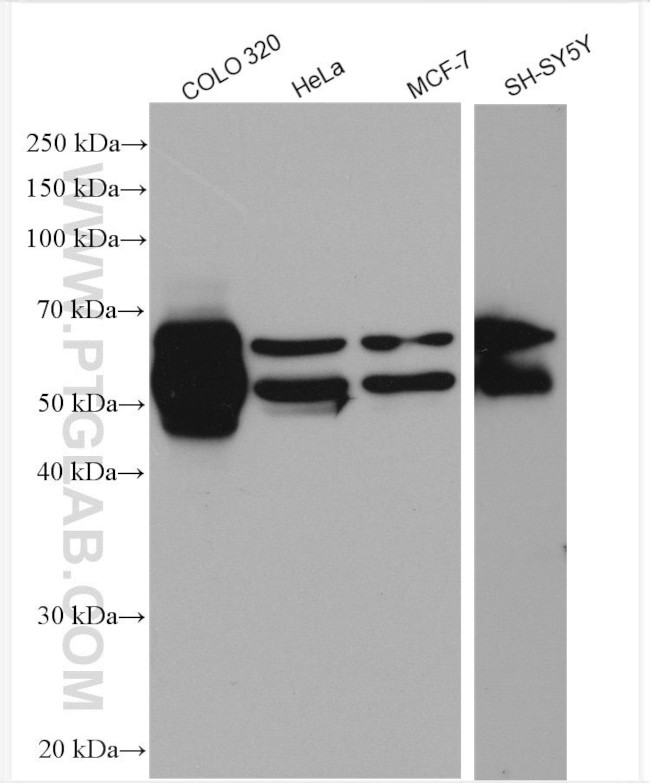 GLS Antibody in Western Blot (WB)