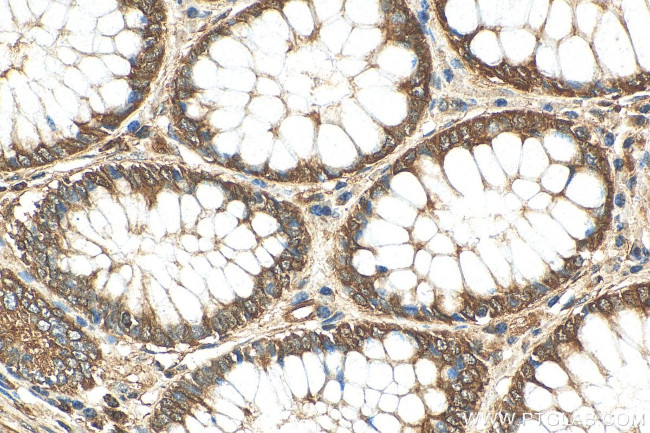 BAK Antibody in Immunohistochemistry (Paraffin) (IHC (P))