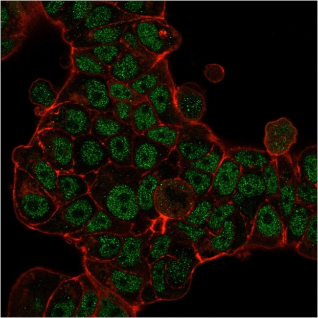 MSH6 (DNA Mismatch Repair Protein) Antibody in Immunocytochemistry (ICC/IF)