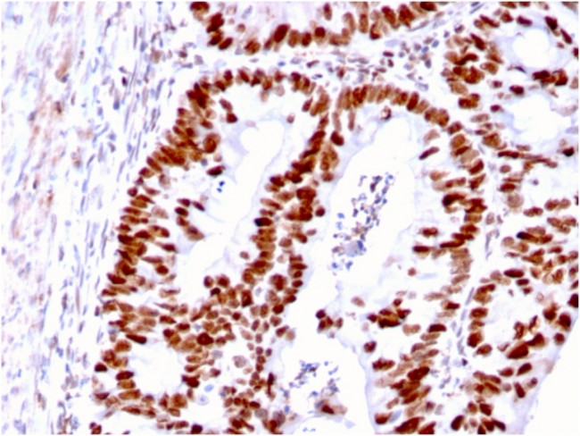 MSH6 (DNA Mismatch Repair Protein) Antibody in Immunohistochemistry (Paraffin) (IHC (P))