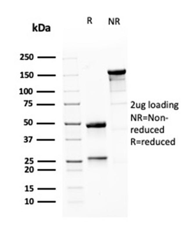 MSH6 (DNA Mismatch Repair Protein) Antibody in SDS-PAGE (SDS-PAGE)