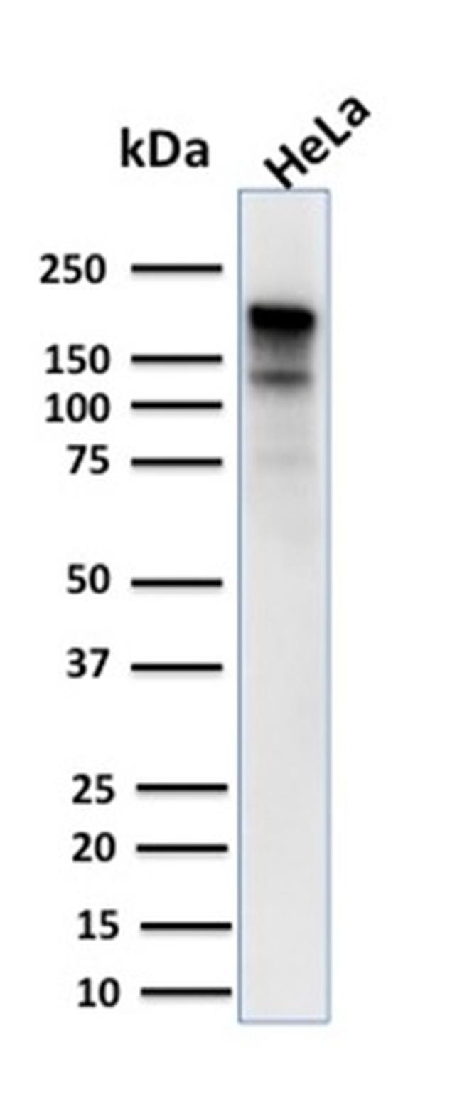 MSH6 (DNA Mismatch Repair Protein) Antibody in Western Blot (WB)